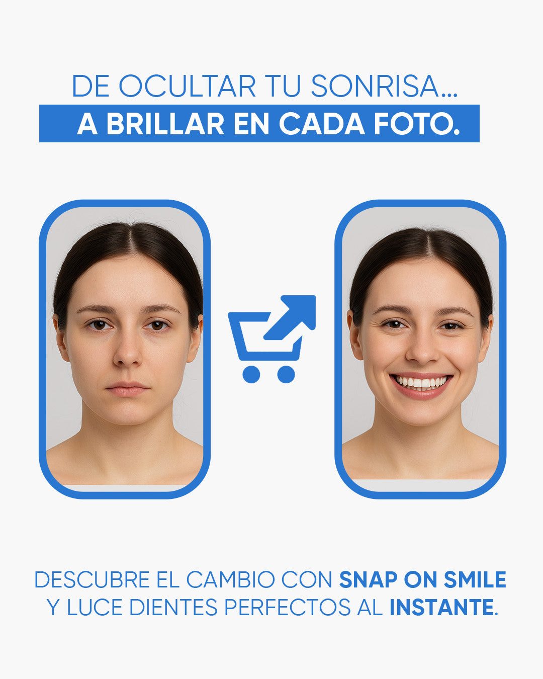 ¡Exclusivas Carillas de Dientes!